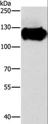 CAST / Calpastatin Antibody - Western blot analysis of Lovo cell, using CAST Polyclonal Antibody at dilution of 1:600.