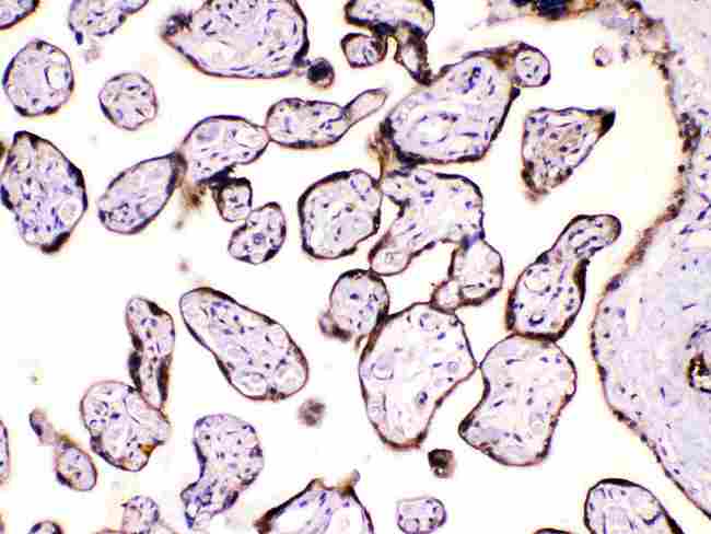 CAST / Calpastatin Antibody - Calpastatin was detected in paraffin-embedded sections of human placenta tissues using rabbit anti- Calpastatin Antigen Affinity purified polyclonal antibody