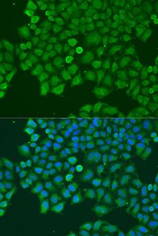 CAST / Calpastatin Antibody - Immunofluorescence analysis of U2OS cells using CAST antibody at dilution of 1:100. Blue: DAPI for nuclear staining.