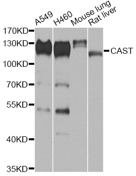 CAST / Calpastatin Antibody - Western blot analysis of extracts of various cell lines, using CAST antibody at 1:1000 dilution. The secondary antibody used was an HRP Goat Anti-Rabbit IgG (H+L) at 1:10000 dilution. Lysates were loaded 25ug per lane and 3% nonfat dry milk in TBST was used for blocking. An ECL Kit was used for detection and the exposure time was 90s.