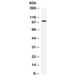 CAST / Calpastatin Antibody - Western blot testing of human COLO320 cell lysate with Calpastatin antibody at 0.5ug/ml. Predicted molecular weight: 76 kDa but routinely observed at ~110 kDa.