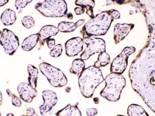 CAST / Calpastatin Antibody - IHC testing of FFPE human placenta tissue with Calpastatin antibody at 1ug/ml. HIER: steam section in pH6 citrate buffer for 20 min.