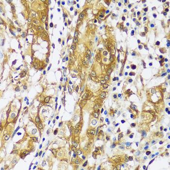 CAST / Calpastatin Antibody - Immunohistochemistry of paraffin-embedded Human stomach using CAST Polyclonal Antibody at dilution of 1:100 (40x lens).