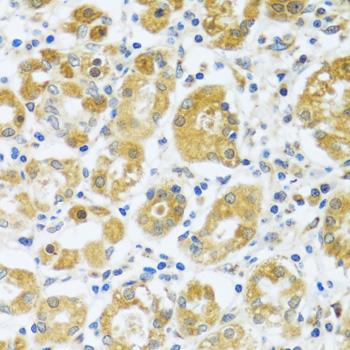 CAST / Calpastatin Antibody - Immunohistochemistry of paraffin-embedded Human stomach using CAST Polyclonal Antibody at dilution of 1:100 (40x lens).