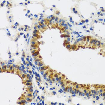 CAST / Calpastatin Antibody - Immunohistochemistry of paraffin-embedded Mouse lung using CAST Polyclonal Antibody at dilution of 1:100 (40x lens).