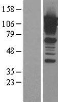 CAST / Calpastatin Protein - Western validation with an anti-DDK antibody * L: Control HEK293 lysate R: Over-expression lysate