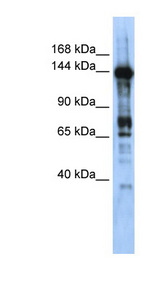 CASZ1 Antibody - CASZ1 antibody Western blot of Transfected 293T cell lysate. This image was taken for the unconjugated form of this product. Other forms have not been tested.