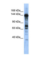 CASZ1 Antibody - CASZ1 antibody Western blot of Transfected 293T cell lysate. This image was taken for the unconjugated form of this product. Other forms have not been tested.