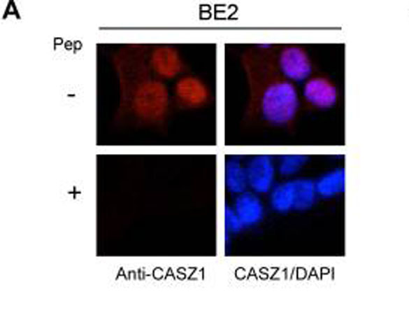 CASZ1 Antibody - Immunofluorescence results of Endogenous CASZ1. Cells: BE2 cells. Pre-Incubation of Anti-CASZ1 Antibody with CASZ1 Peptide: Bottom. Staining: Rabbit Anti-CASZ1 Antibody. Chromatin counter stain: DAPI.