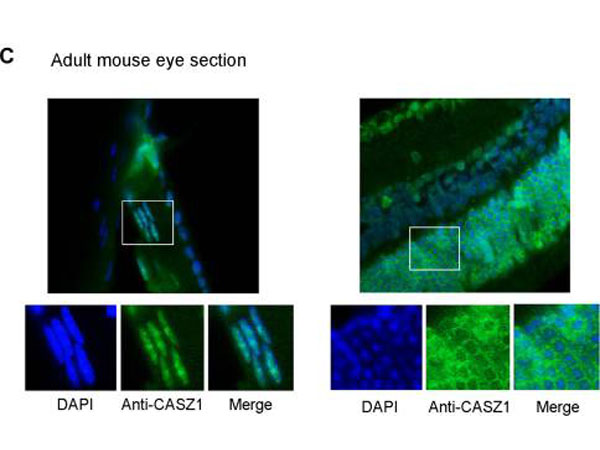 CASZ1 Antibody - Immunofluorescence of rabbit anti-CASZ1 Antibody. Tissue: adult murine ocular tissue. Antibody: Rabbit Anti-CASZ1 Antibody. Counterstain: DAPI. Localization: nucleus in lens epithelia but primarily localizes in the cytoplasm in photoreceptor cells.