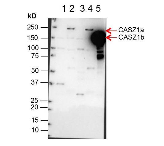 CASZ1 Antibody - Western Blot of Anti-CASZ1 Antibody. Lane 1: NBLS Cytoplasmic (20µg). Lane 2: NBLS Nuclear (3µg). Lane 3: BE2C Cytoplasmic (30µg). Lane 4: BE2C Nuclear (7µg). Lane 5: SY5Y-CASZ1b (10µg). Block: 5% Blotto/TTBS for 1 hour. Primary: Casz1 1:10,000 for 1 hour. Secondary: Goat anti-Rabbit HRP for 1 hour. 240sec exposure. Detects nuclear endogenous CASZ1a and CASZ1b; and transiently transfected CASZ1b isoform.