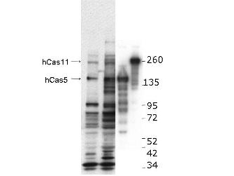 CASZ1 Antibody - Western blot using the anti-hCASZ1 antibody. This blot shows detection of endogenous and transfected human CASZ1 protein in fresh whole cell lysate (~30 µg). Protein was resolved by SDS-PAGE and transferred onto nitrocellulose. After blocking, the membrane was probed with the primary antibody diluted to 1:1,000, incubated 1.5 hours at room temperature, and incubated with HRP-conjugated Goat Anti-Rabbit antibody for 45 min. at room temperature. Lane 1, BE2(s) cell lysate. Lane 2, BE2(N) cell lysate. Lane 3, SY5Y transfected with hCas5 (125kDa). Lane 4, SY5Y transfected with hCas11 (190kDa).