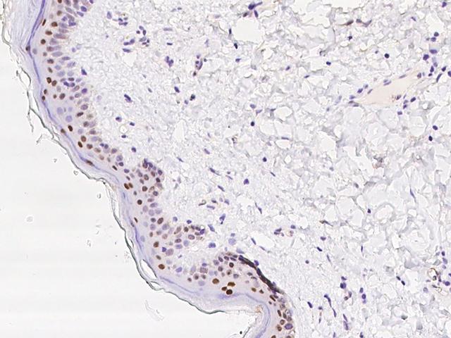 CASZ1 Antibody - Immunochemical staining of human CASZ1 in human skin with rabbit polyclonal antibody at 1:5000 dilution, formalin-fixed paraffin embedded sections.
