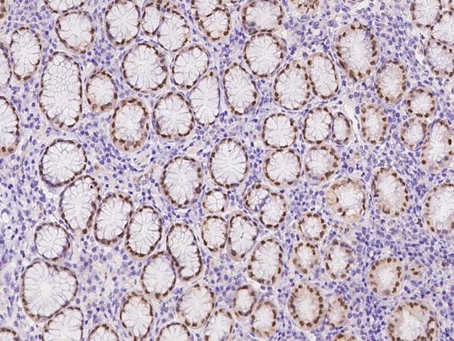 CASZ1 Antibody - Immunochemical staining of human CASZ1 in human stomach with rabbit polyclonal antibody at 1:5000 dilution, formalin-fixed paraffin embedded sections.