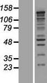 CASZ1 Protein - Western validation with an anti-DDK antibody * L: Control HEK293 lysate R: Over-expression lysate