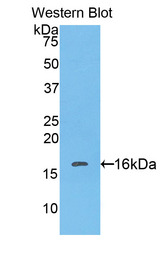 CAT / Catalase Antibody