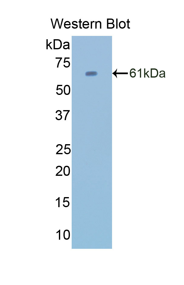 CAT / Catalase Antibody