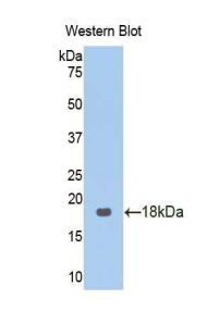 CAT / Catalase Antibody - Western blot of recombinant CAT / Catalase.  This image was taken for the unconjugated form of this product. Other forms have not been tested.