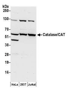 CAT / Catalase Antibody - Detection of human Catalase/CAT by western blot. Samples: Whole cell lysate (50 µg) from HeLa, HEK293T, and Jurkat cells prepared using NETN lysis buffer. Antibody: Affinity purified rabbit anti-Catalase/CAT antibody used for WB at 0.4 µg/ml. Detection: Chemiluminescence with an exposure time of 30 seconds.