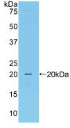 CAT / Catalase Antibody - Western Blot; Sample: Recombinant CAT, Mouse.