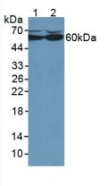 CAT / Catalase Antibody - Western Blot; Sample: Lane1: Human HepG2 Cells; Lane2: Human Hela Cells.