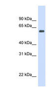 CAT / Catalase Antibody - CAT / Catalase antibody Western blot of Fetal Heart lysate. This image was taken for the unconjugated form of this product. Other forms have not been tested.