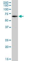 CAT / Catalase Antibody - CAT monoclonal antibody (M08), clone 2G6. Western Blot analysis of CAT expression in HepG2.