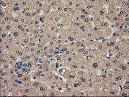 CAT / Catalase Antibody - IHC of paraffin-embedded Human liver tissue using anti-CAT mouse monoclonal antibody. (Heat-induced epitope retrieval by 10mM citric buffer, pH6.0, 100C for 10min).