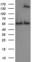 CAT / Catalase Antibody - HEK293T cells were transfected with the pCMV6-ENTRY control (Left lane) or pCMV6-ENTRY CAT (Right lane) cDNA for 48 hrs and lysed. Equivalent amounts of cell lysates (5 ug per lane) were separated by SDS-PAGE and immunoblotted with anti-CAT.