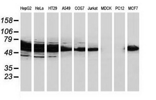 CAT / Catalase Antibody - Western blot of extracts (35ug) from 9 different cell lines by using anti-CAT monoclonal antibody.