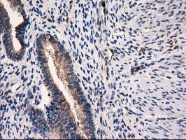 CAT / Catalase Antibody - IHC of paraffin-embedded Human endometrium tissue using anti-CAT mouse monoclonal antibody. (Heat-induced epitope retrieval by 10mM citric buffer, pH6.0, 100C for 10min).