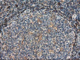 CAT / Catalase Antibody - IHC of paraffin-embedded Human lymph node tissue using anti-CAT mouse monoclonal antibody. (Heat-induced epitope retrieval by 10mM citric buffer, pH6.0, 100C for 10min).