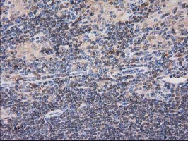CAT / Catalase Antibody - IHC of paraffin-embedded Human lymphoma tissue using anti-CAT mouse monoclonal antibody.