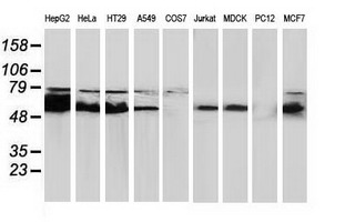 CAT / Catalase Antibody - Western blot of extracts (35 ug) from 9 different cell lines by using anti-CAT monoclonal antibody.