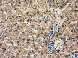 CAT / Catalase Antibody - IHC of paraffin-embedded Human liver tissue using anti-CAT mouse monoclonal antibody.