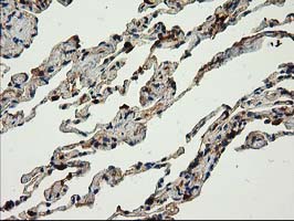 CAT / Catalase Antibody - IHC of paraffin-embedded Human lung tissue using anti-CAT mouse monoclonal antibody.