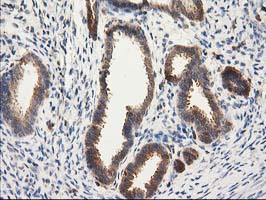 CAT / Catalase Antibody - IHC of paraffin-embedded Human endometrium tissue using anti-CAT mouse monoclonal antibody.
