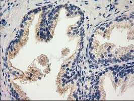CAT / Catalase Antibody - IHC of paraffin-embedded Human prostate tissue using anti-CAT mouse monoclonal antibody.