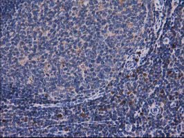 CAT / Catalase Antibody - IHC of paraffin-embedded Human lymph node tissue using anti-CAT mouse monoclonal antibody.