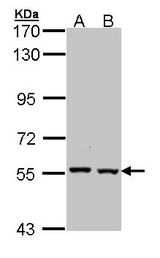 CAT / Catalase Antibody - Sample (30 ug of whole cell lysate). A: Molt-4. B: Raji. 7.5% SDS PAGE. CAT antibody diluted at 1:1000. 