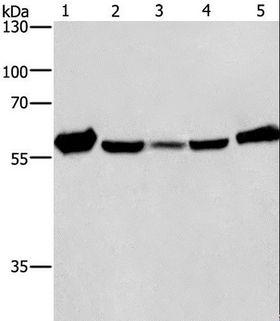 CAT / Catalase Antibody - Western blot analysis of Mouse liver tissue and Raji cell, HeLa, hepG2 and A549 cell, using CAT Polyclonal Antibody at dilution of 1:266.6.
