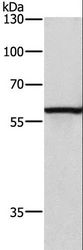 CAT / Catalase Antibody - Western blot analysis of HeLa cell, using CAT Polyclonal Antibody at dilution of 1:300.