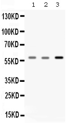 CAT / Catalase Antibody - Western blot - Anti-Catalase Picoband Antibody