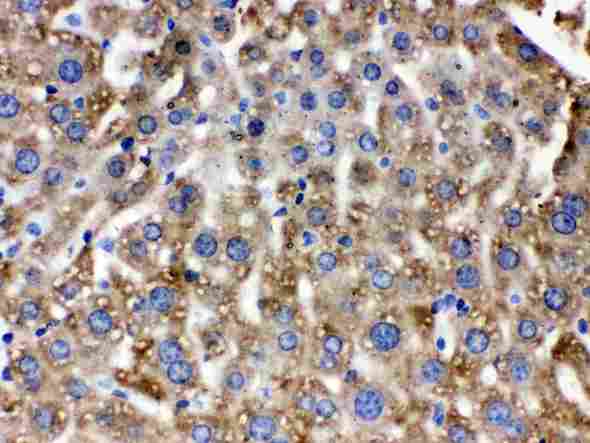 CAT / Catalase Antibody - Catalase was detected in paraffin-embedded sections of mouse liver tissues using rabbit anti- Catalase Antigen Affinity purified polyclonal antibody