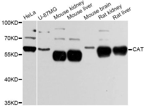 CAT / Catalase Antibody - Western blot analysis of extracts of various cell lines, using CAT Antibody at 1:3000 dilution. The secondary antibody used was an HRP Goat Anti-Rabbit IgG (H+L) at 1:10000 dilution. Lysates were loaded 25ug per lane and 3% nonfat dry milk in TBST was used for blocking. An ECL Kit was used for detection and the exposure time was 5s.