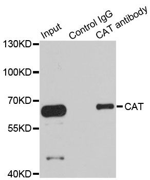 CAT / Catalase Antibody - Immunoprecipitation analysis of 100ug extracts of HepG2 cells using 3ug CAT antibody. Western blot was performed from the immunoprecipitate using CAT antibody at a dilition of 1:1000.