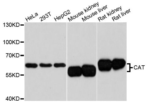 CAT / Catalase Antibody - Western blot analysis of extracts of various cell lines, using CAT antibody at 1:3000 dilution. The secondary antibody used was an HRP Goat Anti-Rabbit IgG (H+L) at 1:10000 dilution. Lysates were loaded 25ug per lane and 3% nonfat dry milk in TBST was used for blocking. An ECL Kit was used for detection and the exposure time was 5s.