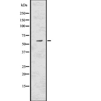 CAT / Catalase Antibody - Western blot analysis of Catalase using HepG2 whole cells lysates