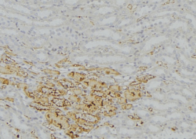 CAT / Catalase Antibody - 1:100 staining mouse kidney tissue by IHC-P. The sample was formaldehyde fixed and a heat mediated antigen retrieval step in citrate buffer was performed. The sample was then blocked and incubated with the antibody for 1.5 hours at 22°C. An HRP conjugated goat anti-rabbit antibody was used as the secondary.