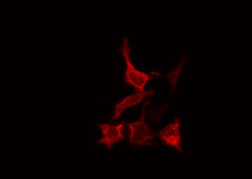 CAT / Catalase Antibody - Staining HeLa cells by IF/ICC. The samples were fixed with PFA and permeabilized in 0.1% Triton X-100, then blocked in 10% serum for 45 min at 25°C. The primary antibody was diluted at 1:200 and incubated with the sample for 1 hour at 37°C. An Alexa Fluor 594 conjugated goat anti-rabbit IgG (H+L) antibody, diluted at 1/600, was used as secondary antibody.